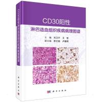 CD30阳性淋巴造血组织疾病病理图谱 刘卫平,王哲 著 生活 文轩网