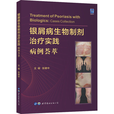 银屑病生物制剂治疗实践 病例荟萃 张建中 编 生活 文轩网