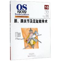 膝.踝关节及足趾截骨术 (日)安田和则 著 常非 张大光 译 生活 文轩网