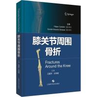 膝关节周围骨折9787547839867上海科学技术出版社