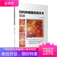 妇科肿瘤腹腔镜手术图解