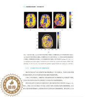 [醉染正版]脑定量磁共振成像:物理测量原理 脑科脑部疾病成像技术与诊断 MRI核磁共振影像学成像分析图书 医学类影像科医