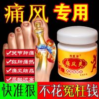 风湿类风湿膝关节手关节痛风肿痛肩周炎关节僵硬老寒腿手指变形