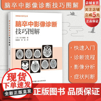 脑卒中影像诊断技巧图解 影像诊断 读片技巧 影像解剖 北京科学技术