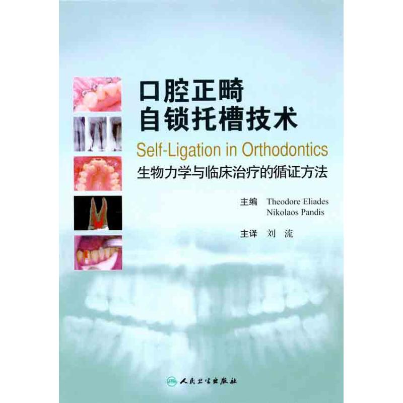 口腔正畸自锁托槽技术 生物力学与临床治疗的循证方法 刘流 主译 著 生活 文轩网