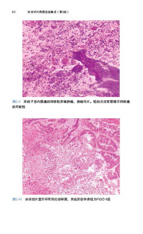 冰冻切片病理活检解读(第2版)