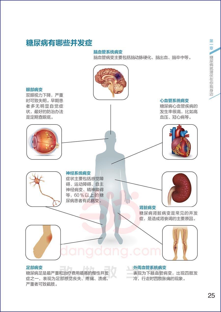 向红丁图解糖尿病"三五"防糖法 9787518411795