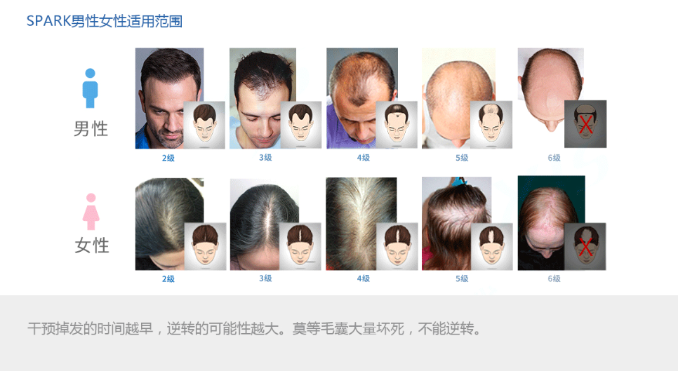 spark斯帕克 激光生发增发帽 光疗脂溢性脱发头