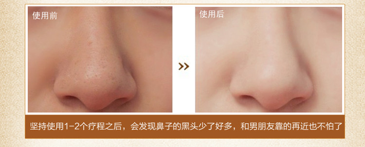 MeiKing 美康粉黛黑头粉黑头收缩毛孔 去粉刺T区护理男女通用20g【报价、价格、评测、参数】_眼\/鼻贴膜_苏宁易购