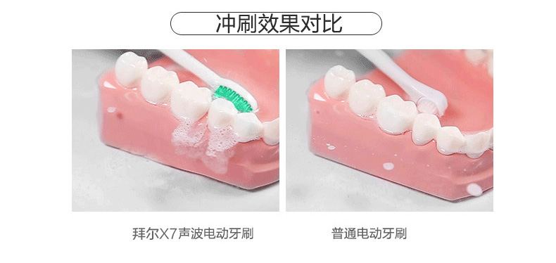 拜尔（BAIR）X7 智能充电式5档电动牙刷 智能提醒 成人声波震动 钻石白