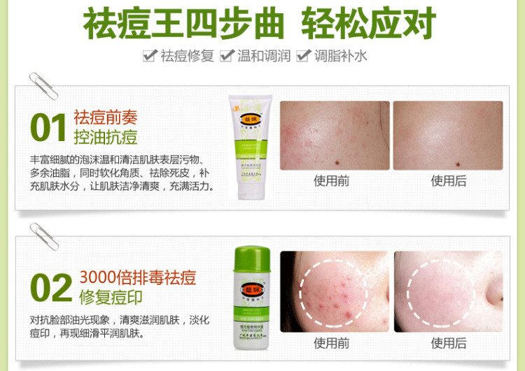 馥珮祛痘王套装洁面膏80g精华液25ml修复膏18g凝胶8g