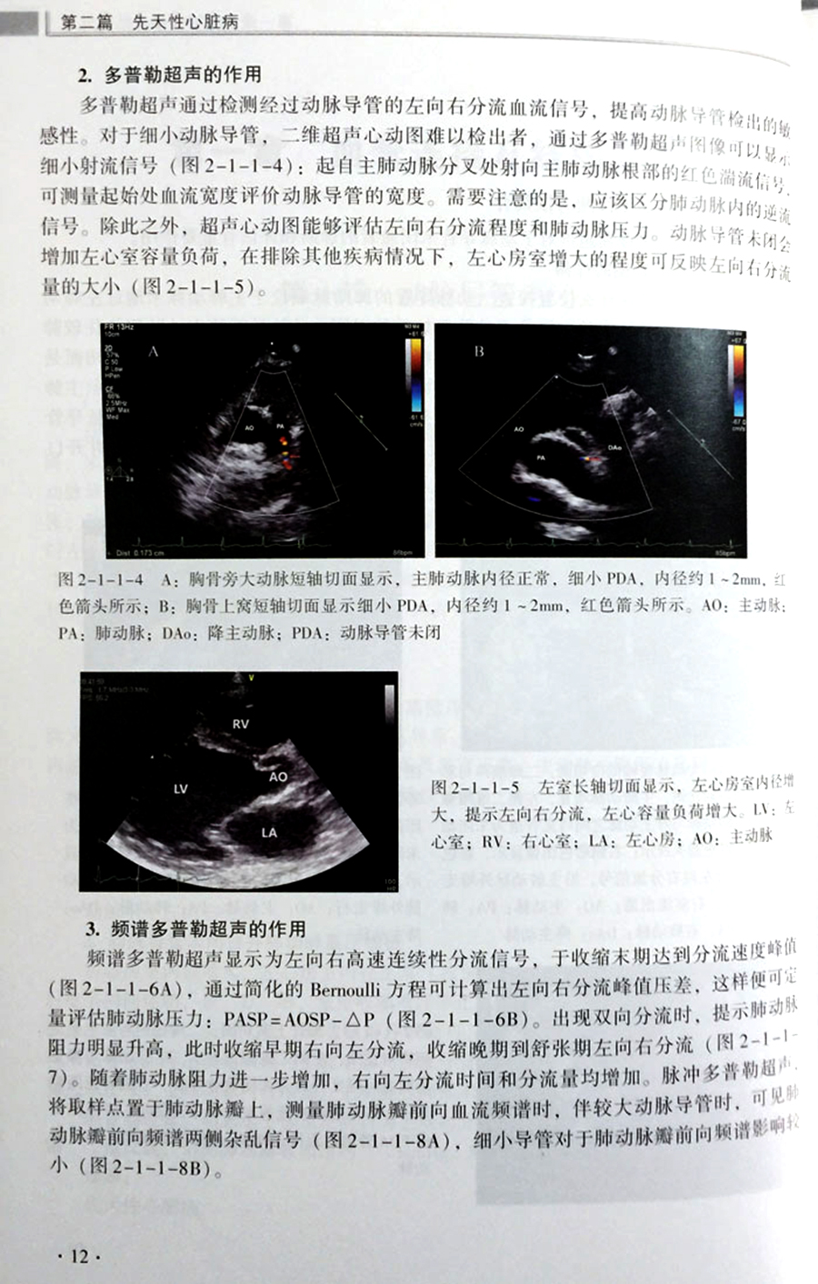 阜外医院心血管超声模板