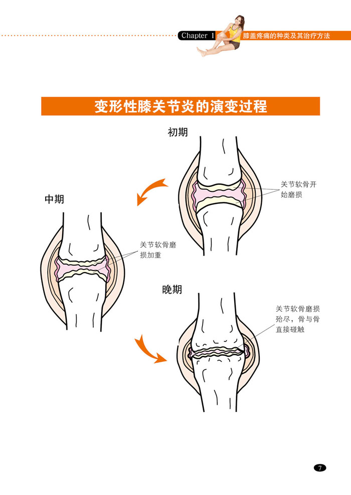 膝盖痛肩痛腰痛自我治疗法