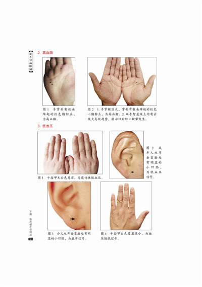 辽宁科学技术出版社中医上篇〓手诊入门 一,中医手诊医学 二,指甲各