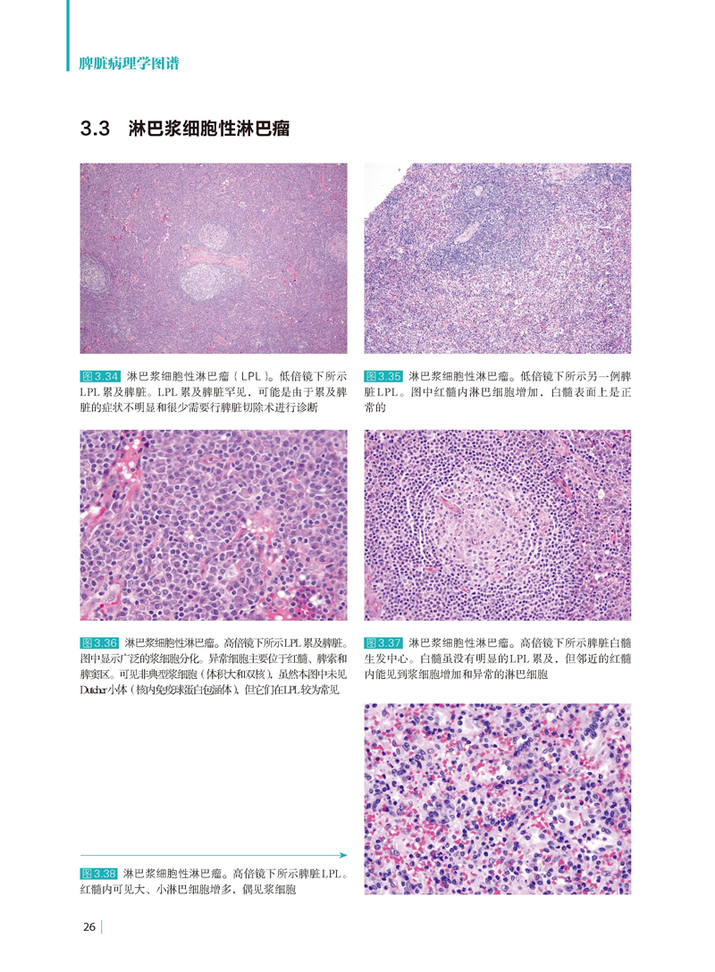 脾脏病理学图谱