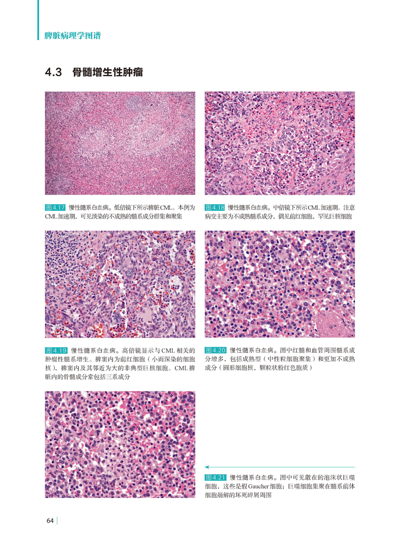 脾脏病理学图谱