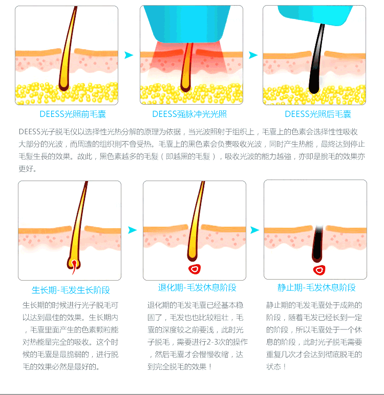 永久脱毛 家用 光子脱毛器去腿毛腋下除毛嫩肤