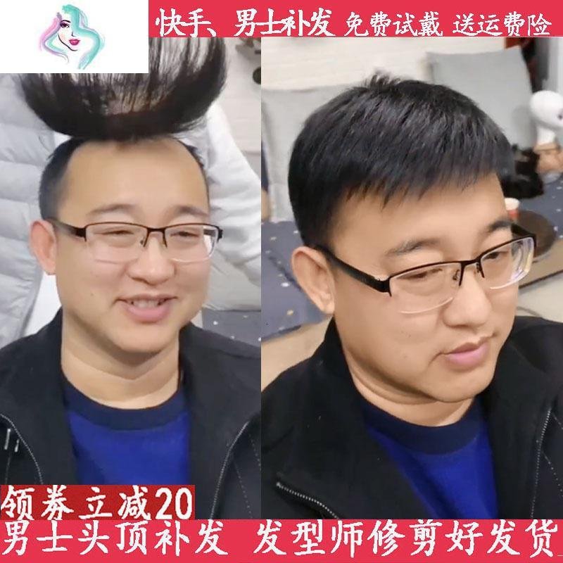 假发男短发头顶补发片男士假发帅气韩版男隐形无痕地秃顶中海假发 你那么美 全手织【18*20】_563