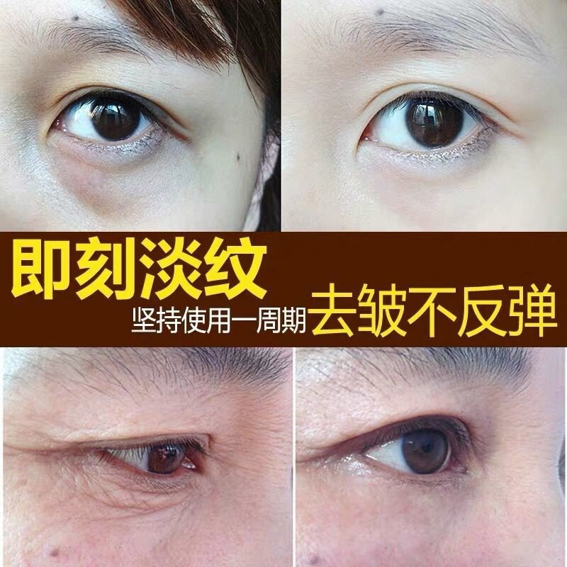 花月情赋活贵妇青春眼膜黑眼圈去眼袋抗皱细纹补水保湿眼贴胶原蛋白眼贴紧致抗皱眼贴膜男女通_1