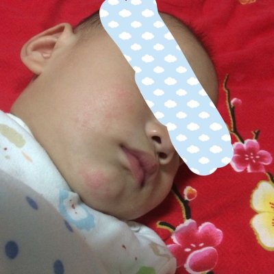 加州宝宝金盏花面霜 婴儿润肤保湿缓解敏感皮肤湿疹 57克 california