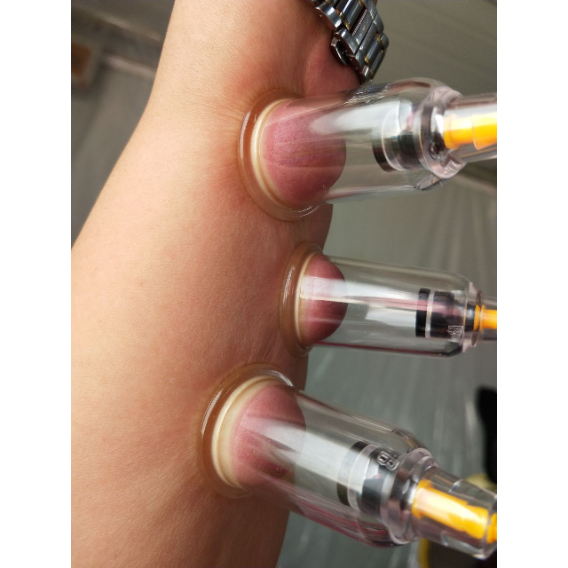 吕氏拔罐器家用24罐个抽气式加厚磁疗拔罐拔火罐拔气罐非玻璃防爆