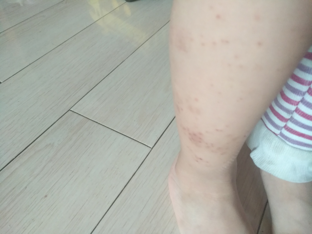 【环球hi淘】【假一赔百】美国艾维诺aveeno婴童润肤婴儿湿疹深层滋润