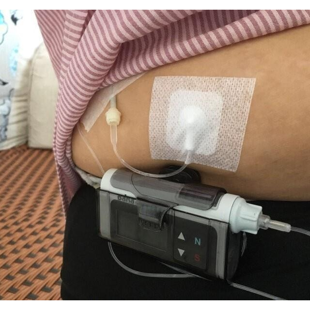 进口丹纳胰岛素泵储药器成人儿童丹纳胰岛素泵耗材(单个装需要一盒拍