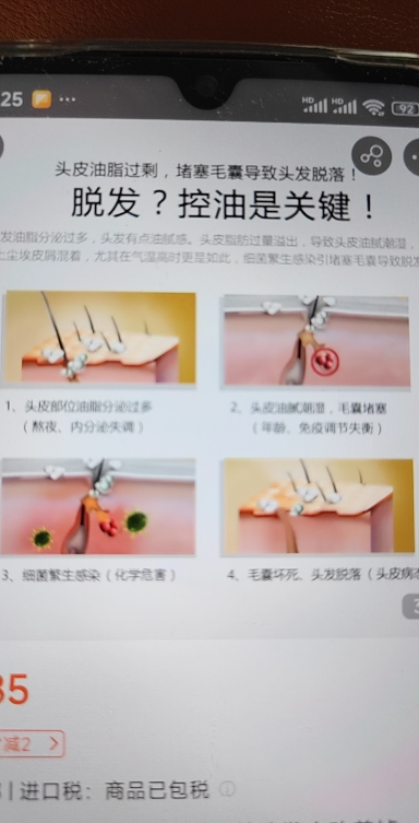 Atreus 泰国AT生姜洗发水 无硅油深层清洁强韧发丝去屑止痒控油防脱防掉发 400ml晒单图