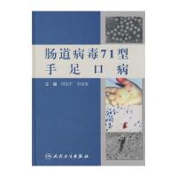 肠道病毒71型手足口病