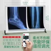 医院X光观片灯 遥控调光免维护(超薄双联) 1个