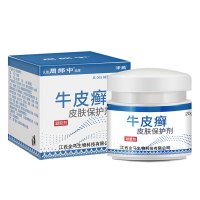 周郎中牛皮癣银屑专用手足癣大腿内侧股部全身皮肤瘙痒外用止痒