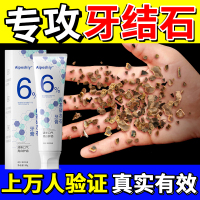 去黄速效美白牙膏洗白牙齿去除黄牙结石器溶解牙石去口臭男士专用