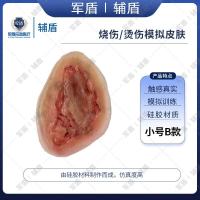 辅盾 军盾 仿生伤情模拟教学烧伤/烫伤贴片-小号B款