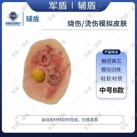 辅盾 军盾 仿生伤情模拟教学烧伤/烫伤贴片-中号B款