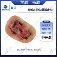 辅盾 军盾 仿生伤情模拟教学烧伤/烫伤贴片-中号A款