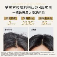 滋源生姜防脱固发洗发水侧柏叶无硅油强韧修护防发男女士油性535ml