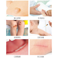 碘酒消毒喷雾100ml