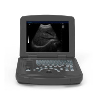 大为医疗(DAWEI)笔记本全数字超声诊断仪B超机便携式超声诊断仪 黑白超 DW-510标配腹部探头一支