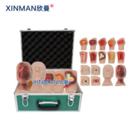 欣曼(XINMAN)XM-SQ16A 人员中毒仿真模型 神经性毒剂中毒芥子气/路易氏剂中毒