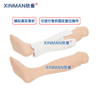欣曼(XINMAN)XM-GZ02 Colles克雷氏下肢小腿骨折处理模拟训练模型