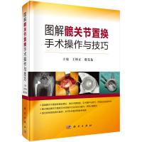 图解髋关节置换手术操作与技巧(精) 王坤正,张先龙 著 生活 文轩网