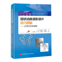 冠状动脉造影读片技巧图解:正常及异常造影 (日)中川义久//林秀隆 著 朱舜明//刘巍//郭艳杰//李国栋 译 生活 