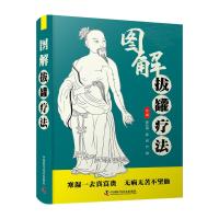 图解拔罐疗法 郭长青 著 郭长青 编 生活 文轩网