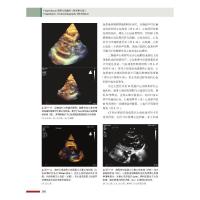 Feigenbaum超声心动图学 原书第8版 (美)威廉·F.阿姆斯壮,(美)托马斯·瑞安 著 谢明星 译 生活 文轩网