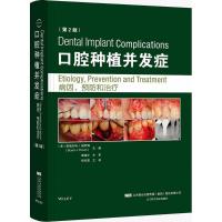 口腔种植并发症 (美)斯图尔特 J.福罗姆(Stuart J.Froum) 主编;轩东英 主译 生活 文轩网