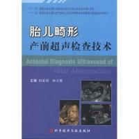 胎儿畸形产前超声检查技术 田家玮 著作 田家玮 孙立涛 主编 生活 文轩网