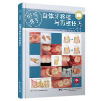 预售自体牙移植与再植技巧 (日)平井 友成 著 生活 文轩网