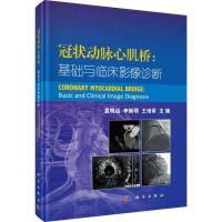 冠状动脉心肌桥:基础与临床影像诊断 编者:袁明远//李新明//王培军 著 袁明远,李新明,王培军 编 生活 文轩网