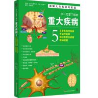 你一定要了解的重大疾病5