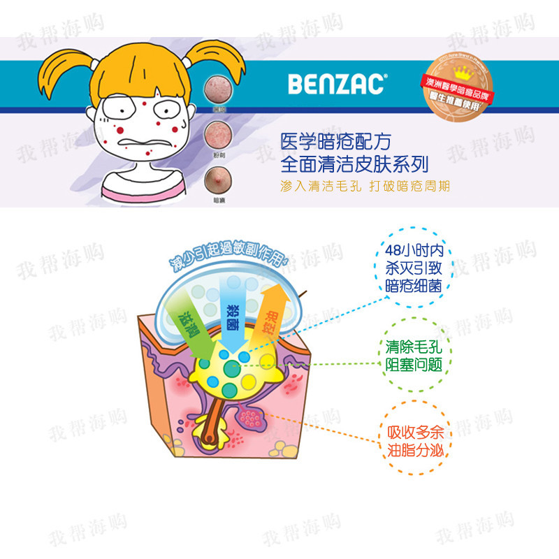 祛痘去粉刺黑头三件套(膏乳液洗面奶)2件装 GALDERMA\Benzac 清洁毛孔 温和护肤[海外购 澳洲直邮]